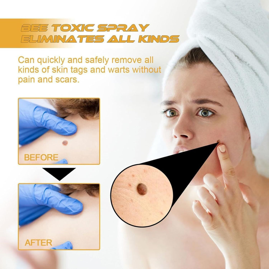 Tag recede Bees Treatment Spray - Arabinox