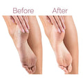 Electric Pedicure Foot File Callus Remover - Arabinox