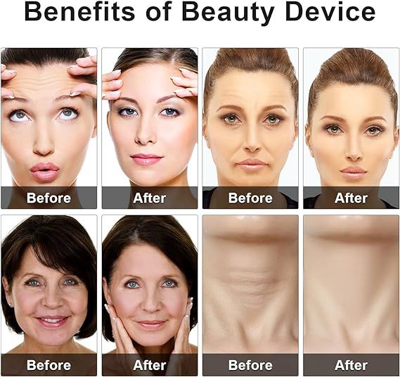 Eye Beauty Device - Arabinox