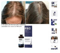 Hair Growth Spray - Arabinox