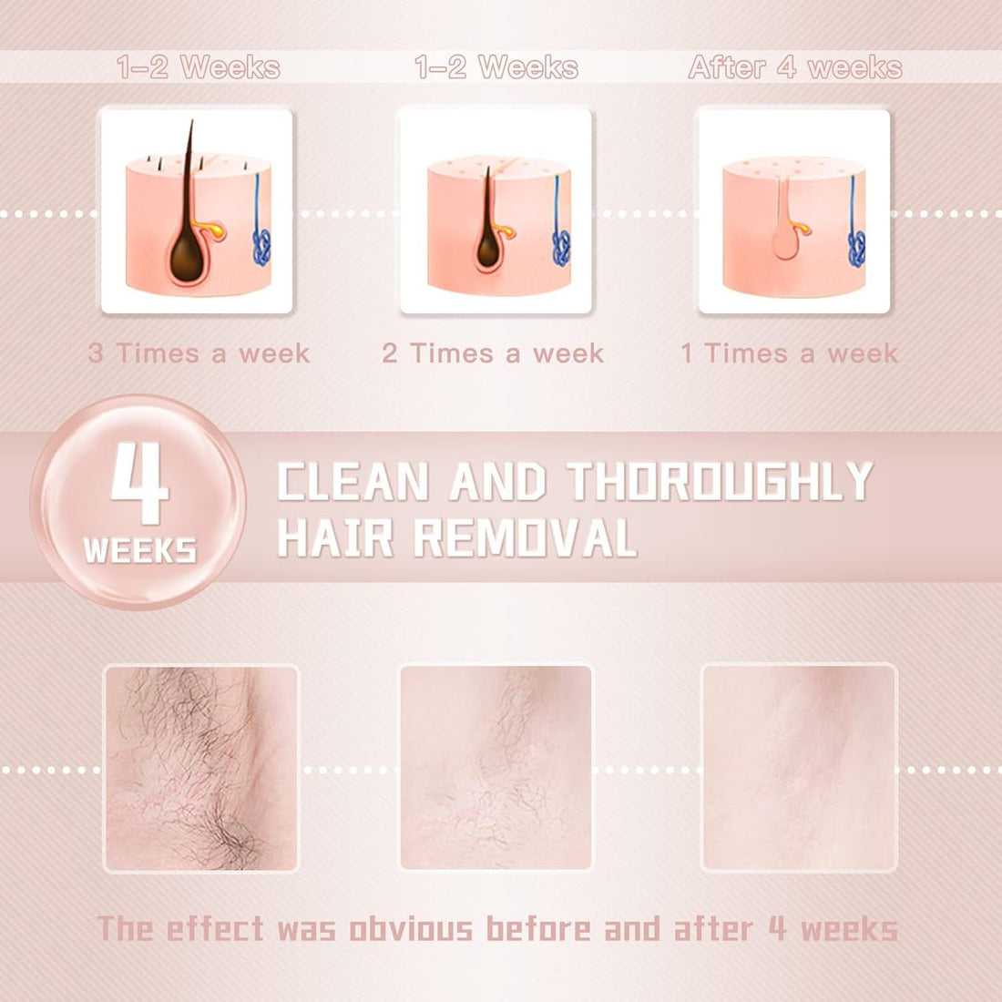 IPL Laser Hair Removal Device for Women and Men - Arabinox