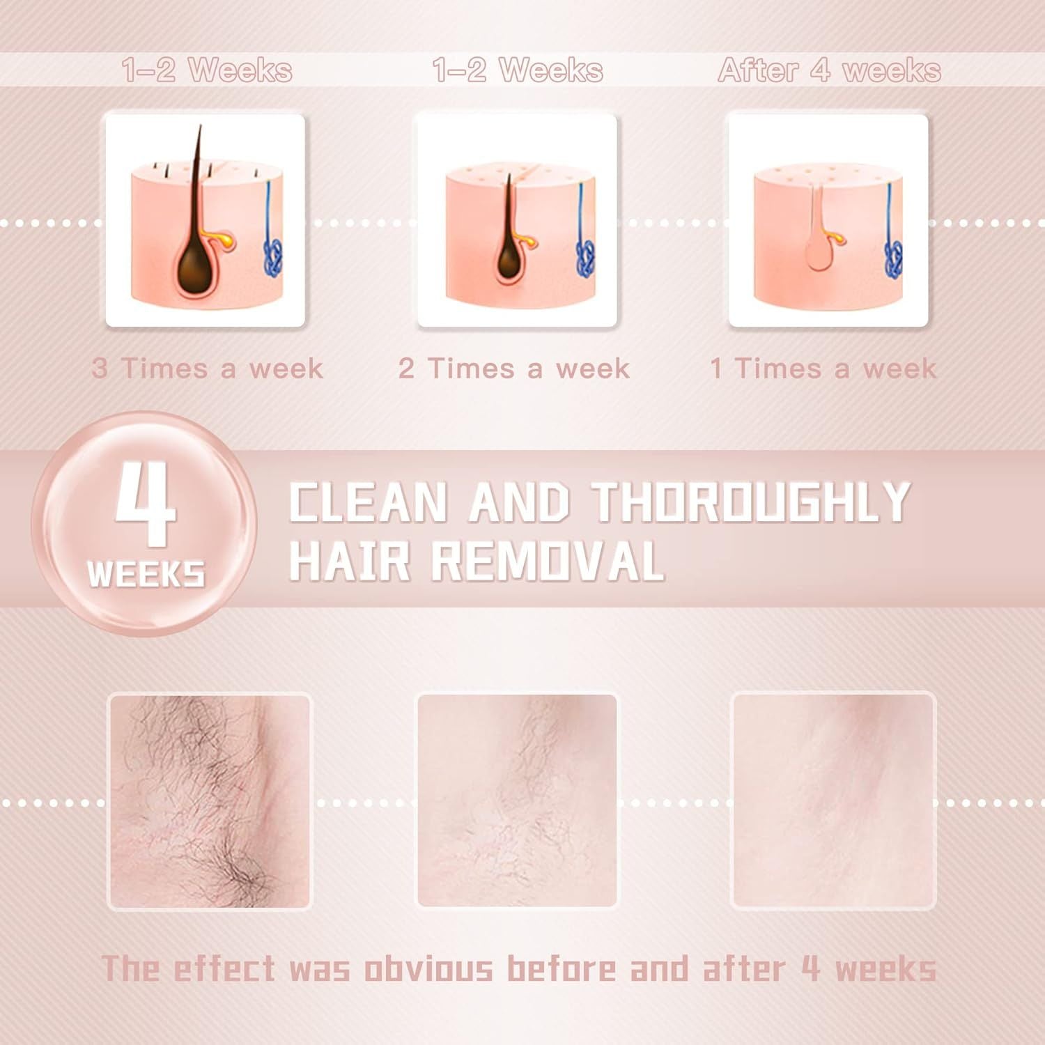 IPL Laser Hair Removal Device for Women and Men - Arabinox