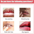 Lips Bleaching Cream Balm - Arabinox