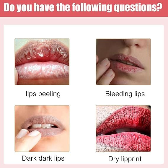 Lips Bleaching Cream Balm - Arabinox