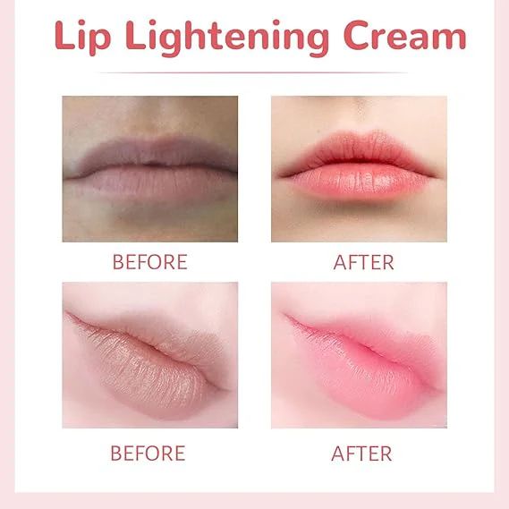 Lips Bleaching Cream Balm - Arabinox