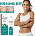 Medical Scar Removal Spray - Arabinox