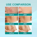 Medical Scar Removal Spray - Arabinox