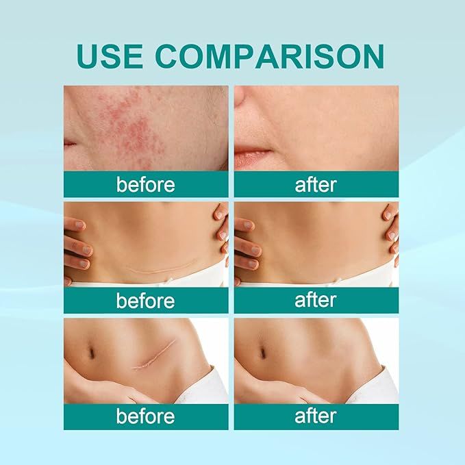 Medical Scar Removal Spray - Arabinox
