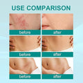 Medical Scar Removal Spray - Arabinox