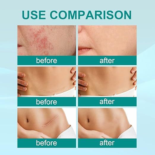 Medical Scar Removal Spray - Arabinox