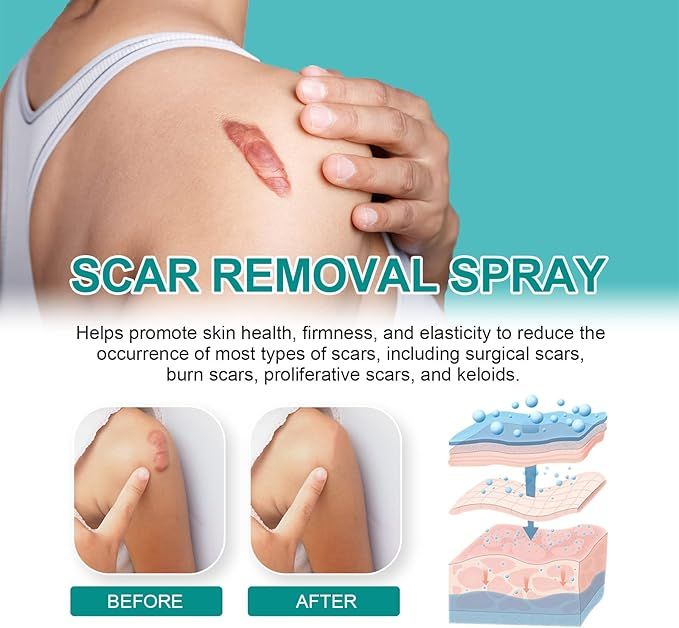 Medical Scar Removal Spray - Arabinox