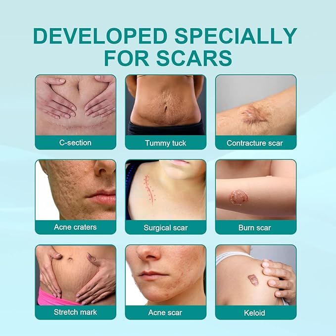 Medical Scar Removal Spray - Arabinox
