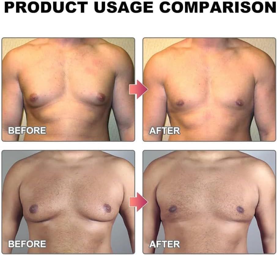 MenTherm Bee Venom Gynecomastia Heating Oil - Arabinox