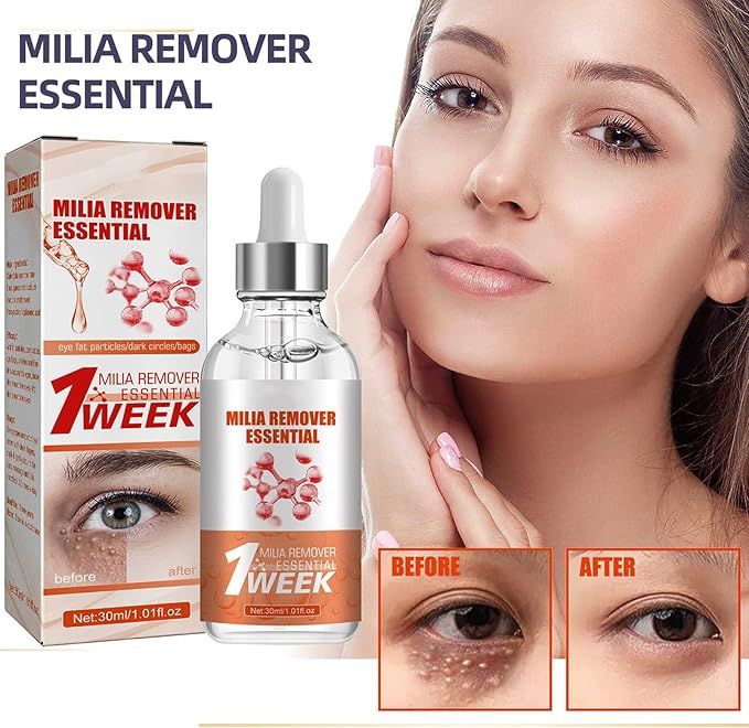 Smooth Milia Remover Serum (30ml) - Arabinox