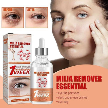 Smooth Milia Remover Serum (30ml) - Arabinox