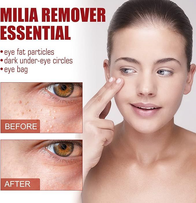 Smooth Milia Remover Serum (30ml) - Arabinox