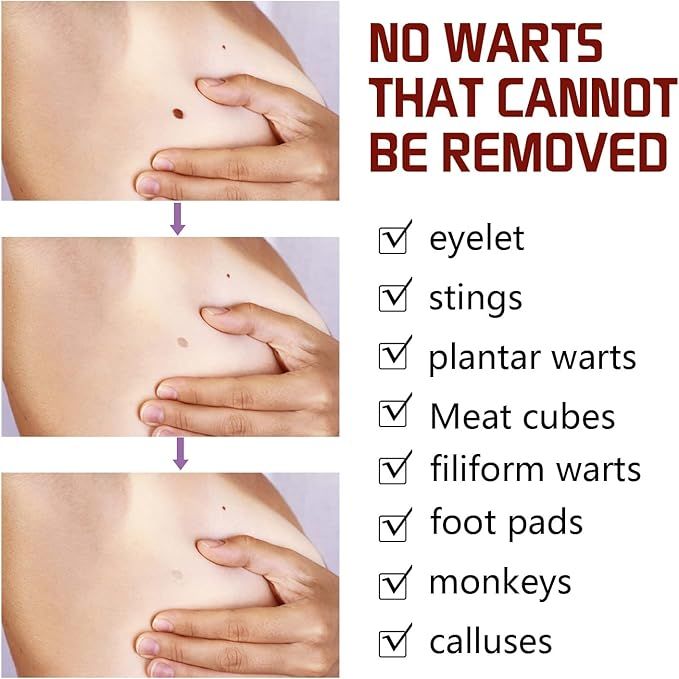tags and moles remover - Arabinox