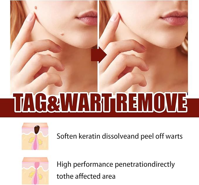 tags and moles remover - Arabinox