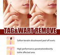 tags and moles remover - Arabinox