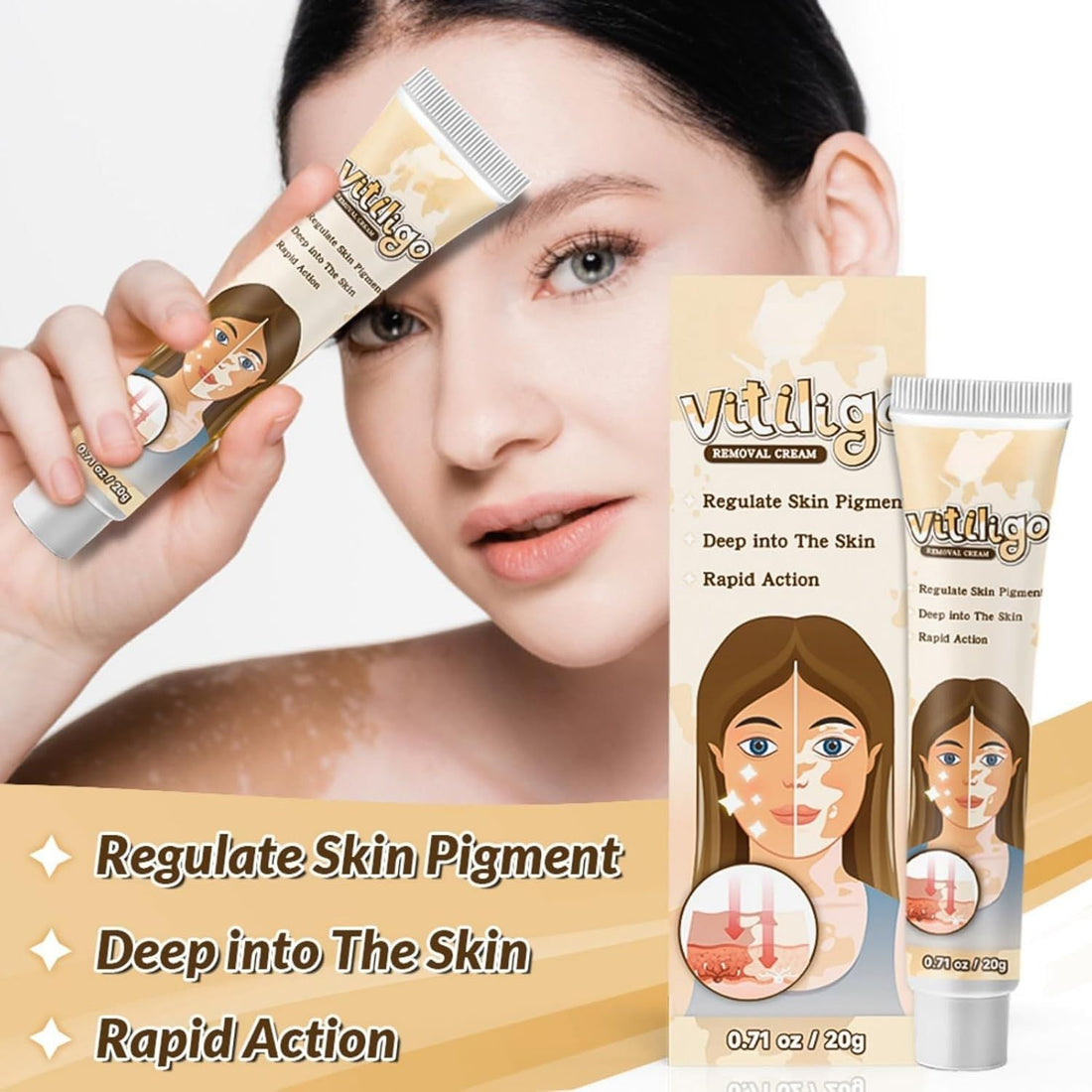 Vitiligo Removal Cream - Arabinox