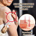 Vitiligo Removal Cream - Arabinox