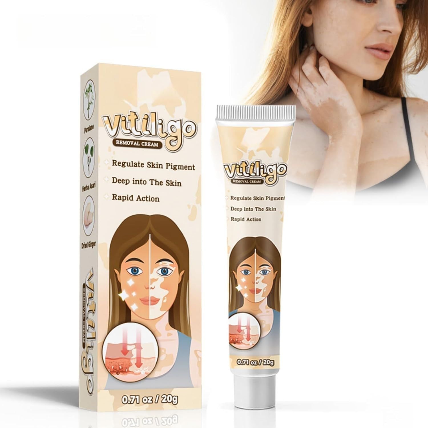 Vitiligo Removal Cream - Arabinox