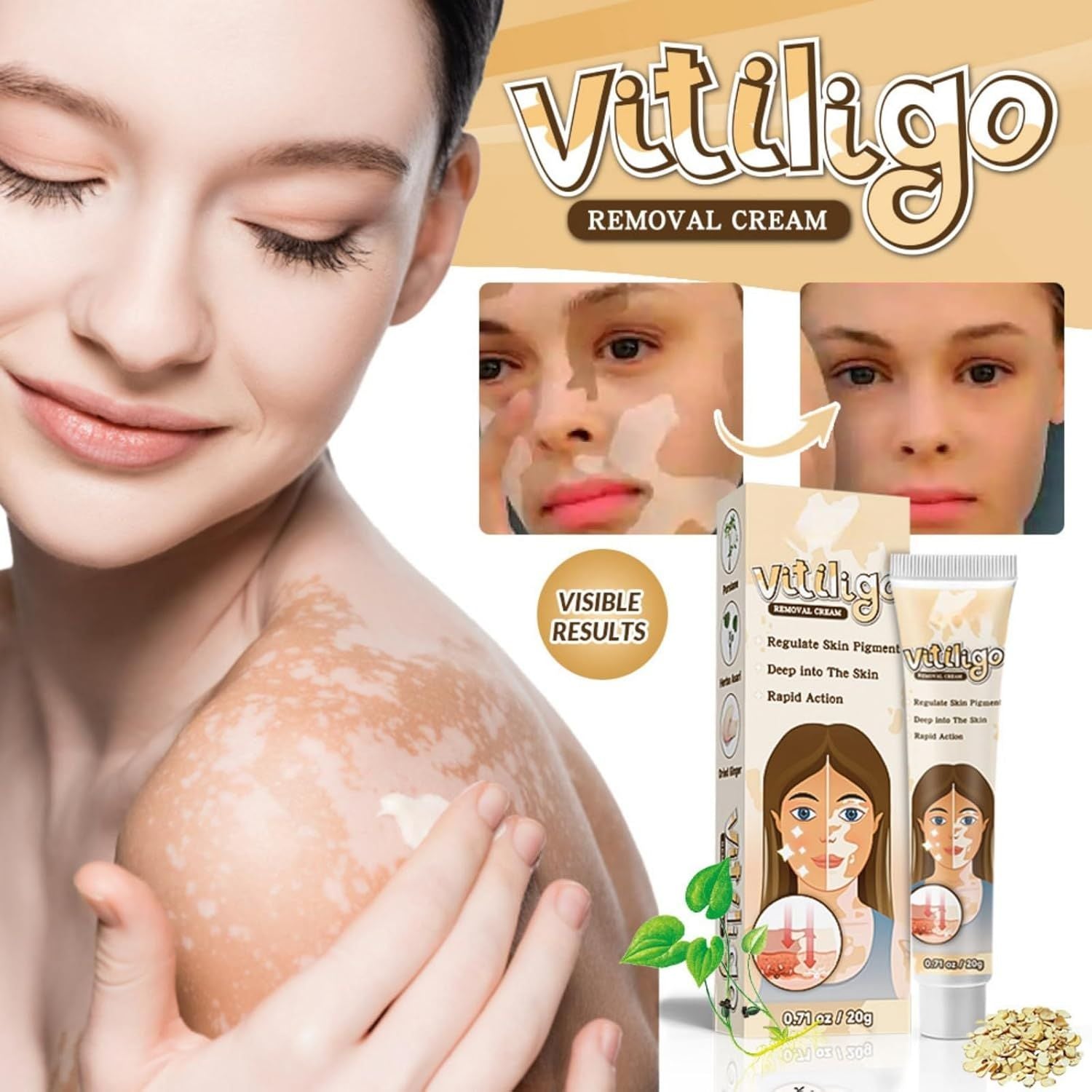 Vitiligo Removal Cream - Arabinox